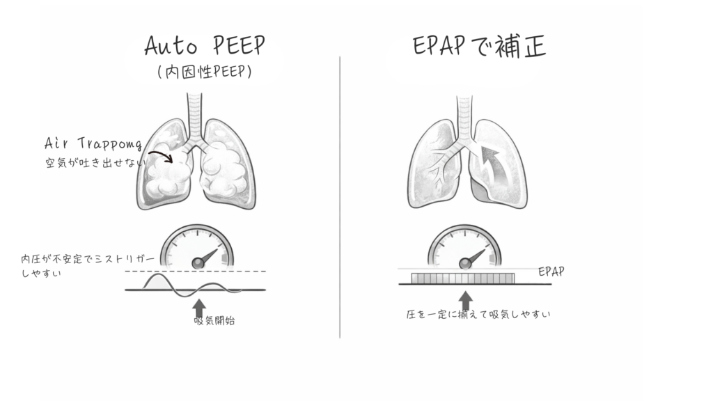 COPDの内因性PEEPに対してEPAPが有効な理由を解説。