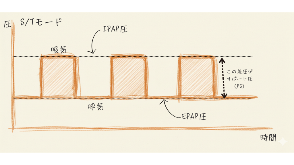 NPPVのS/Tモードについて解説