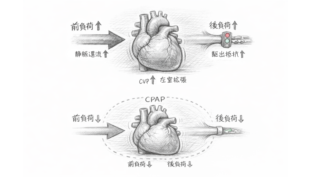 心不全の前負荷と後負荷に対するNPPVのCPAPの効果を解説。