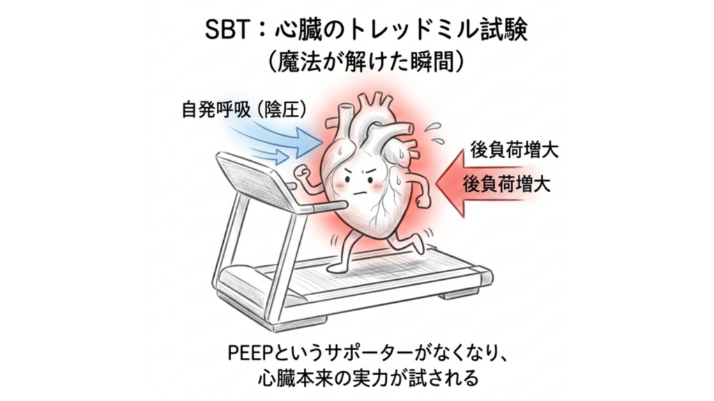 抜管とは心臓のトレッドミル試験