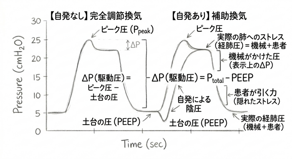 完全調節換気と自発がある補助換気のドライビングプレッシャーの考え方の違い。